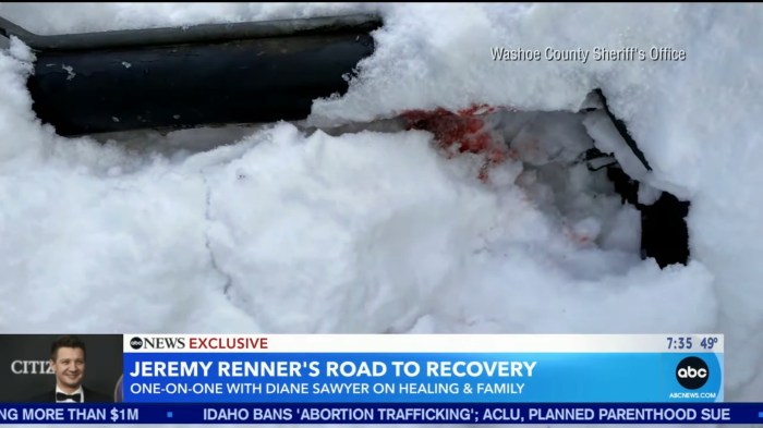 Jeremy renner speaks out in first interview after harrowing snowplow accident i was awake through every moment