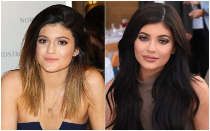 Kylie jenner before surgery after plastic now vs then she getty changes drastic years just weight loss look her what Hailey bieber chloe bailey and so many other celebs reach out after kylie jenner reveals first look at baby aire